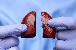 中国癌症早死率下降  男性乳腺癌等早死率现区域性增长