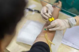 中国超六成血脂异常患者未治疗 高危群体管控严重失守