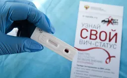Мурашко предложил протестировать на ВИЧ треть россиян