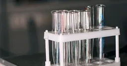 實驗中遭「化骨水淋頭」！ 北海道大學學生1死2傷